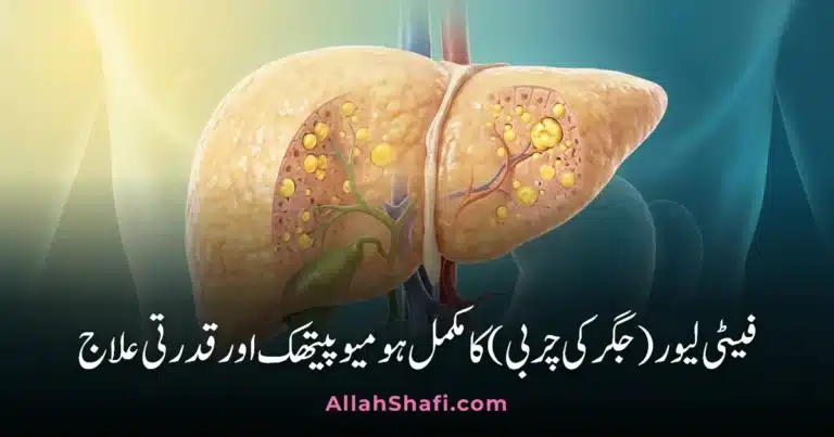فیٹی لیور (جگر کی چربی) کا مکمل ہومیوپیتھک اور قدرتی علاج