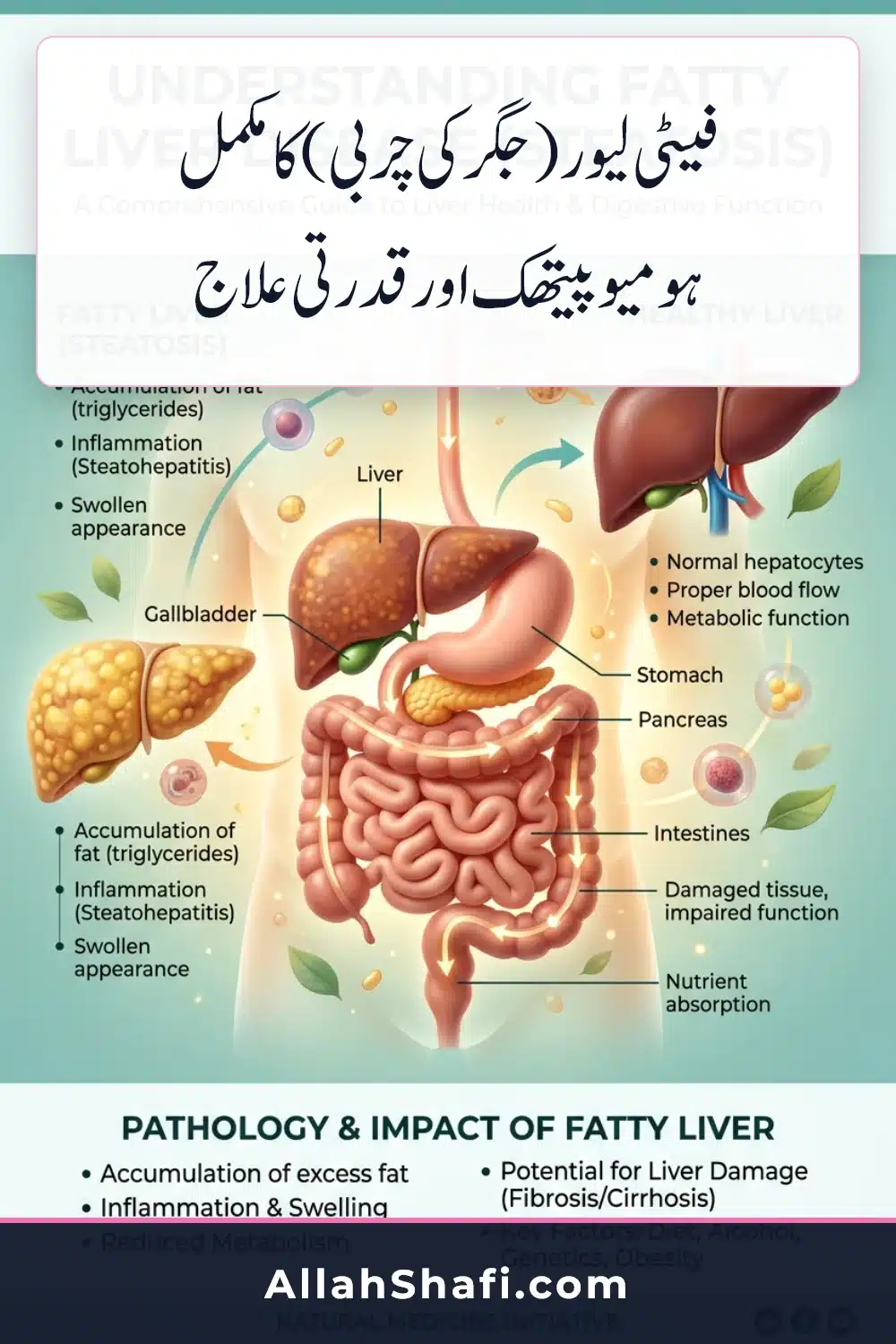 Fatty liver urdu treatment infographic pin