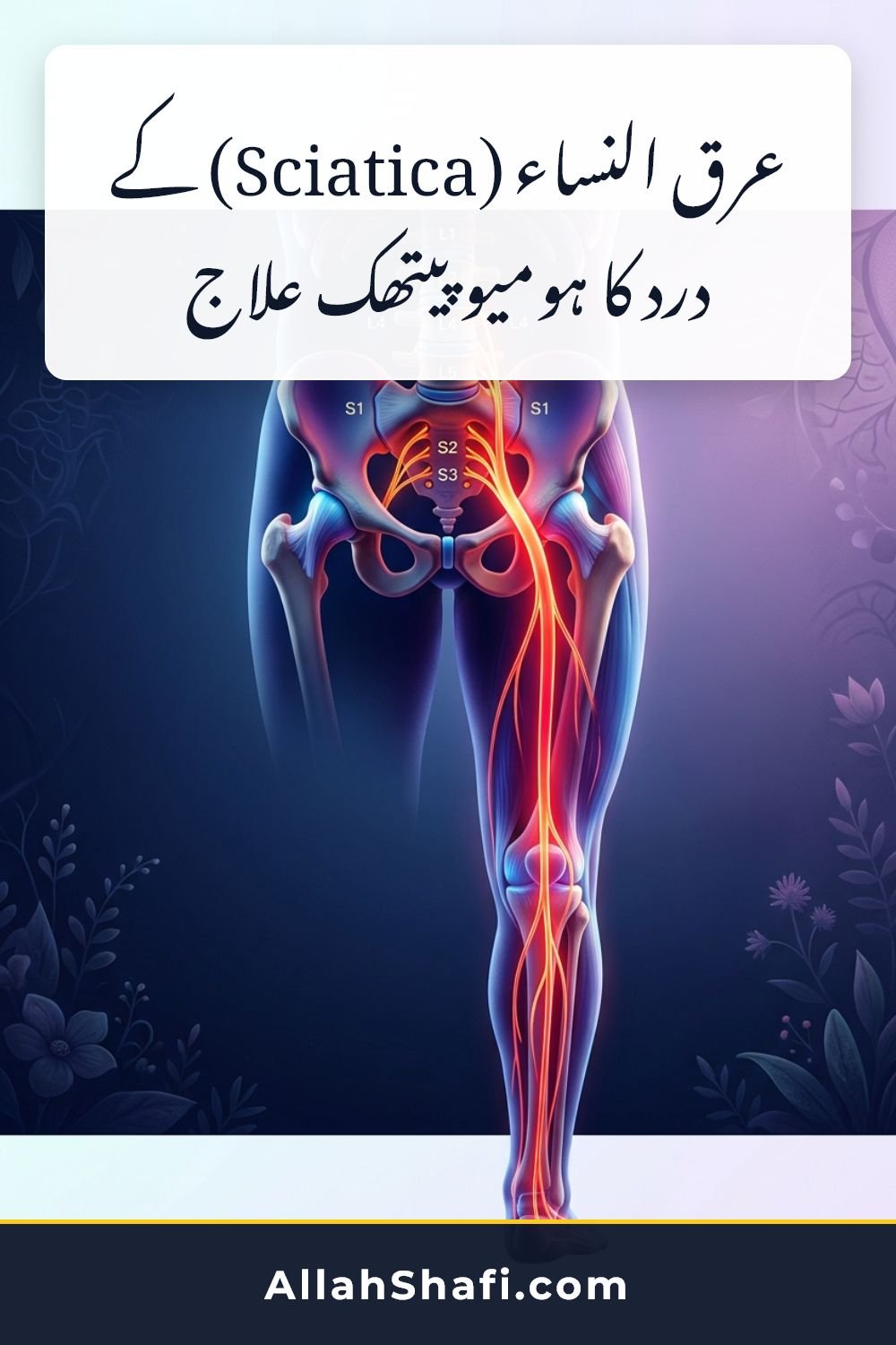 عرق النساء (Sciatica) کے درد کا ہومیوپیتھک علاج عرق النساء کے درد کا ہومیوپیتھک علاج sciatica urdu pin