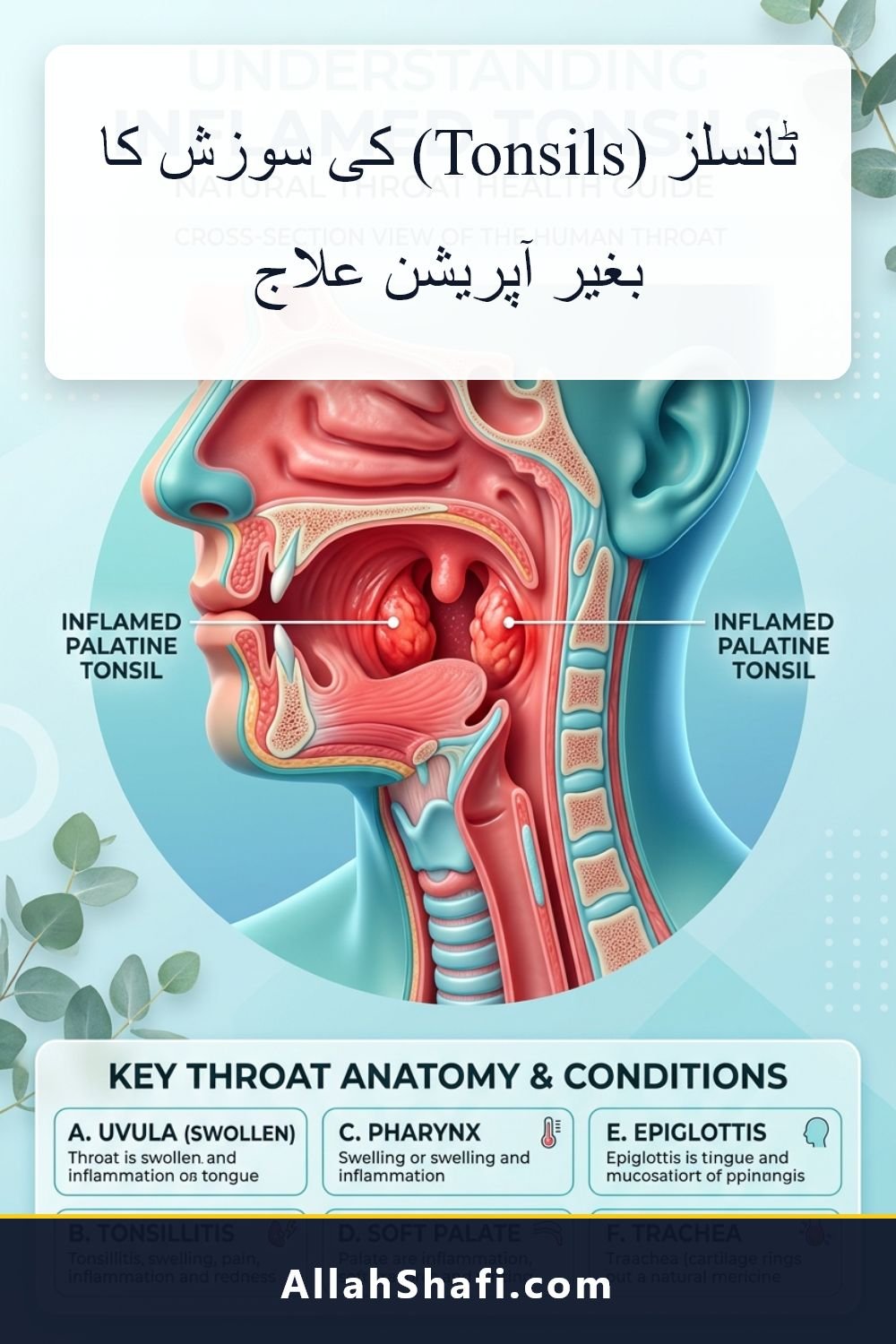 ٹانسلز (Tonsils) کی سوزش کا بغیر آپریشن علاج ٹانسلز کی سوزش کا بغیر آپریشن علاج tonsillitis urdu pin