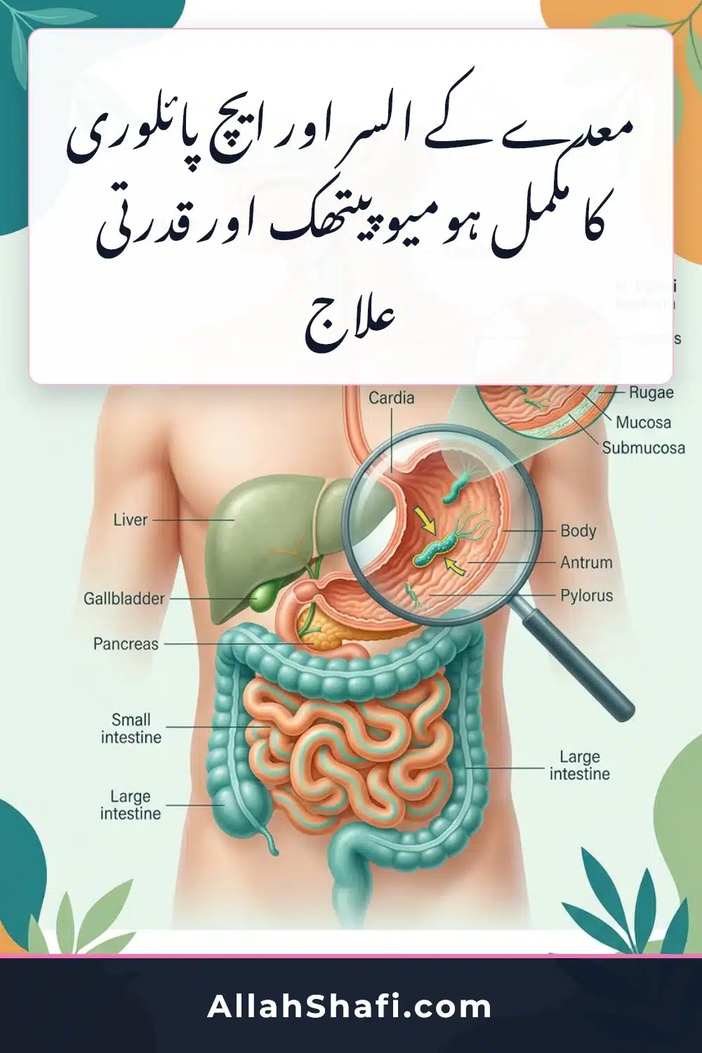معدے کا السر اور ایچ پلوری کا علاج — علامات، ٹیسٹ اور قدرتی شفا H Pylori Treatment Gastric Ulcer H Pylori urdu treatment infographic pin