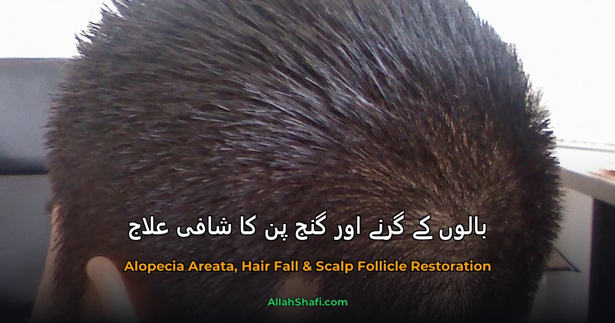 بالوں کے گرنے (Hair Fall) اور گنج پن کا قدرتی علاج