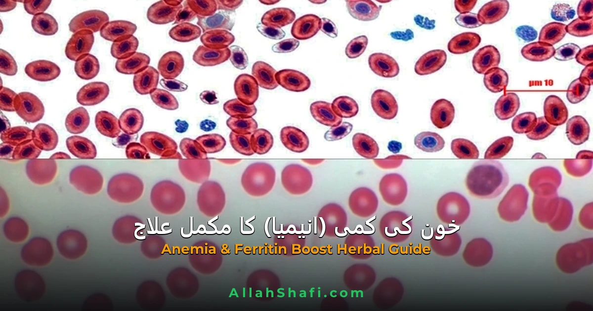 خون کی کمی اور فیریٹن بڑھانے کا علاج — علامات، غذا اور قدرتی گائیڈ