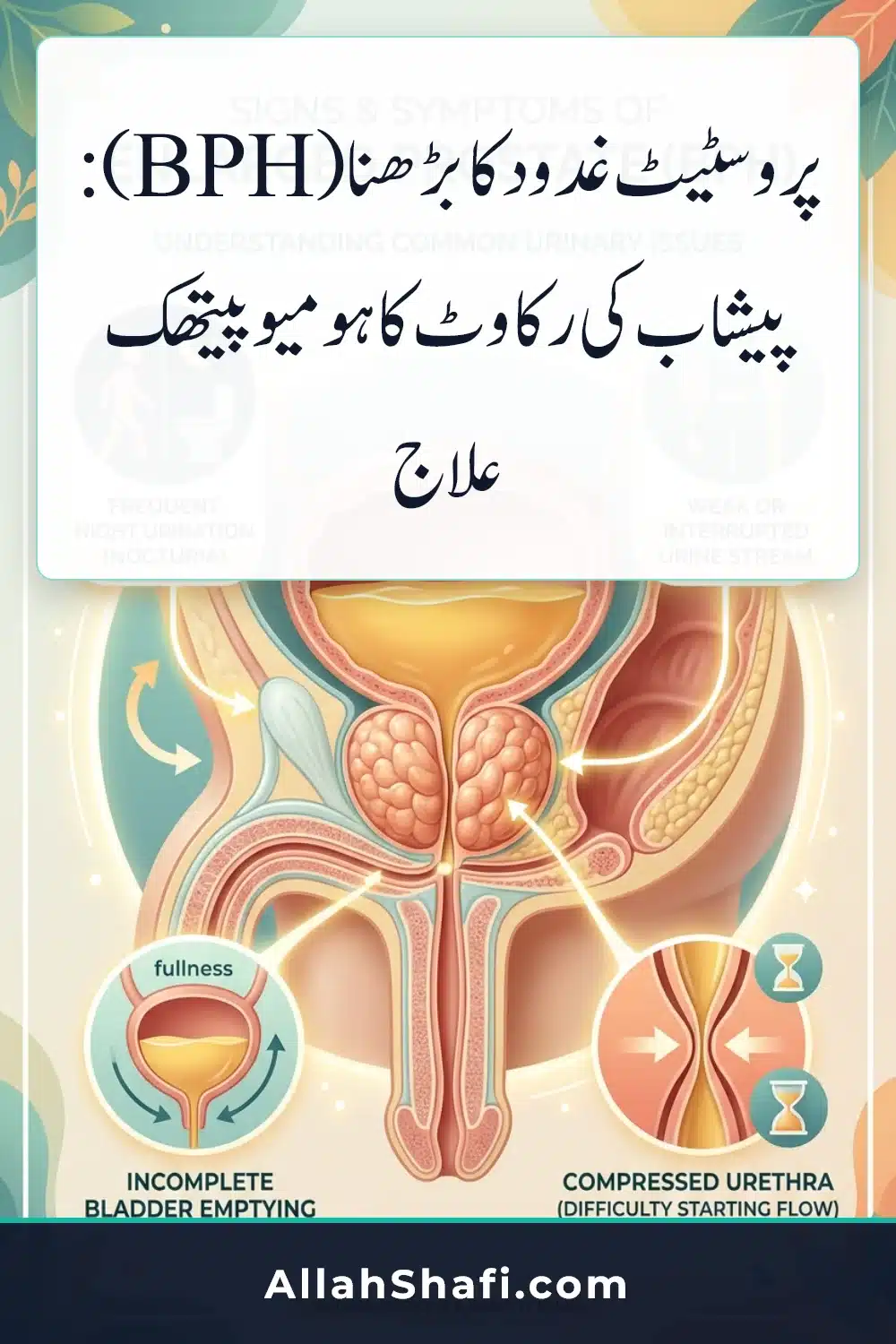 Enlarged Prostate BPH Homeopathic Treatment Urdu infographic pin