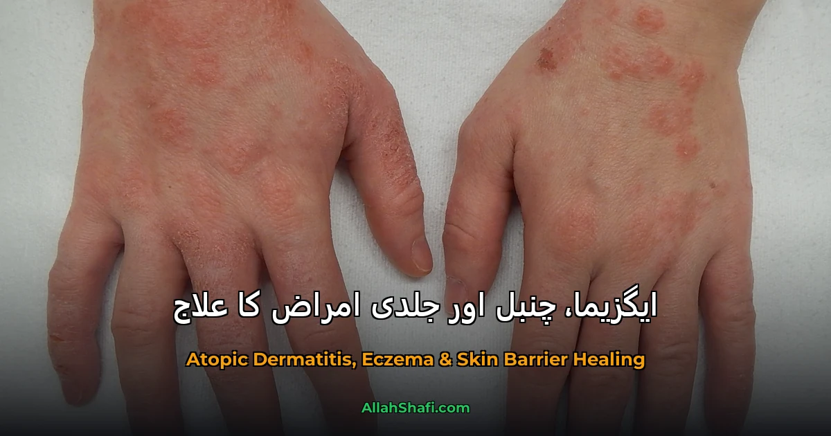 ایگزیما اور جلدی بیماریوں کا ہومیوپیتھی علاج