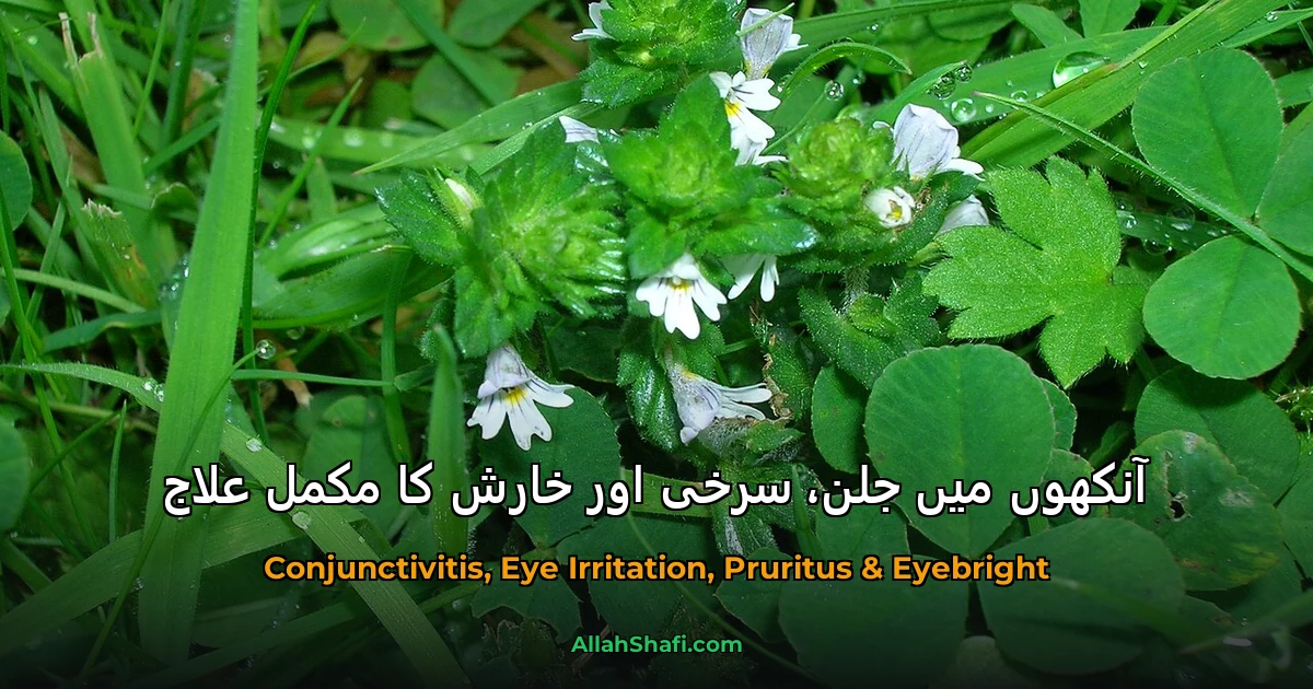 آنکھوں میں جلن، سرخی اور خارش کا مکمل علاج