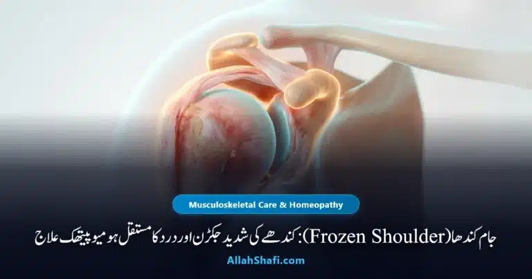 جام کندھا فروزن شولڈر اور بازو کی حرکت بحال کرنے کا قدرتی ہومیوپیتھک طریقہ شفا