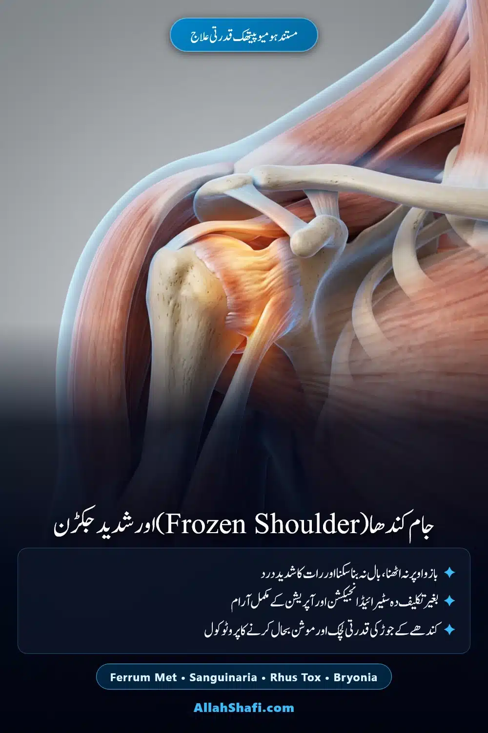 جام کندھا اور کندھے کی جکڑن کا ہومیوپیتھک علاج پن