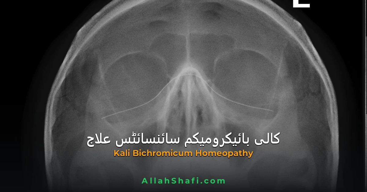 کالی بائیکرومیکم (Kali Bichromicum) — کیرا گرنا، سائنوسائٹس اور چپکنے والے بلغم کا ہومیوپیتھک علاج