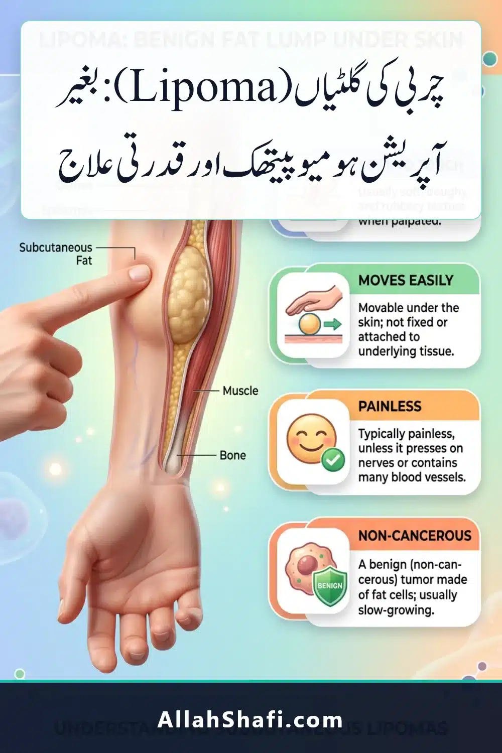 Lipoma Homeopathic Cure Urdu Infographic Pin