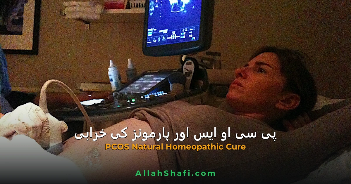 پی سی او ایس (PCOS) اور ہارمونز کی خرابی کا مکمل ہومیوپیتھک علاج
