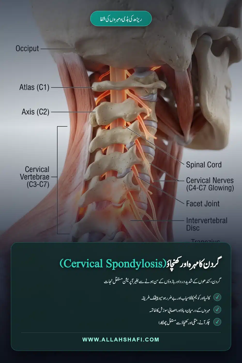 گردن کا مہرہ سروائیکل سپونڈائیلوسس ہومیوپیتھک علاج