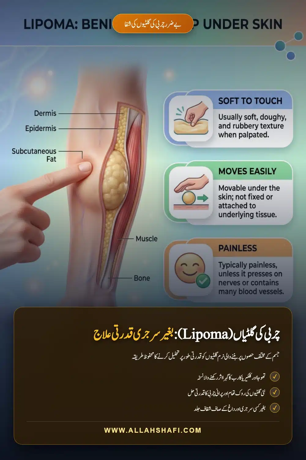 لائپوما چربی کی گلٹیاں بغیر آپریشن ہومیوپیتھک علاج
