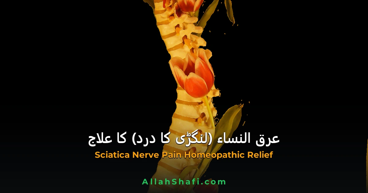 عرق النساء (Sciatica) کے درد کا ہومیوپیتھک علاج