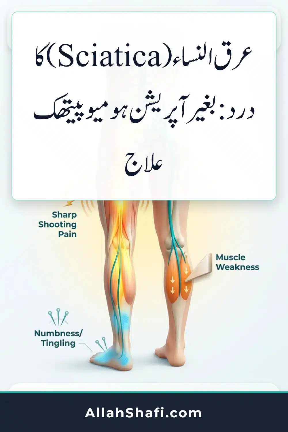 Sciatica Nerve Pain Relief Homeopathic Treatment Urdu infographic pin