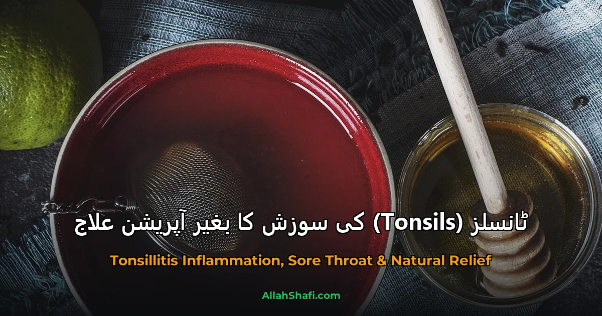 ٹانسلز (Tonsils) کی سوزش کا بغیر آپریشن علاج