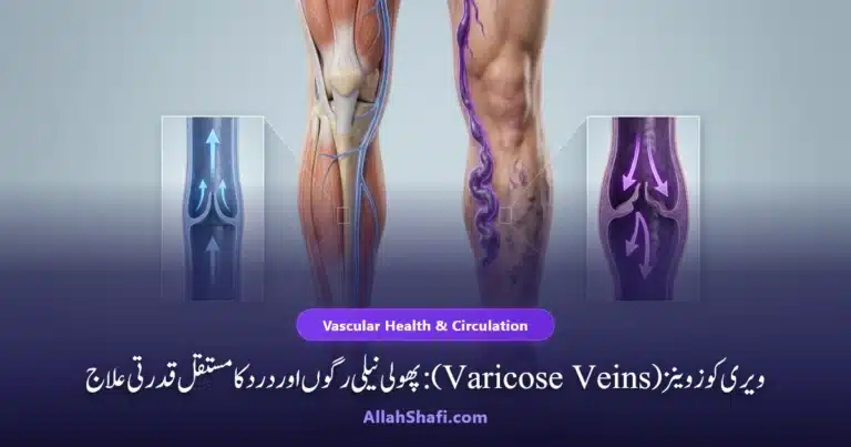 ویری کوز وینز اسباب علامات اور ہومیوپیتھک طریقہ شفا
