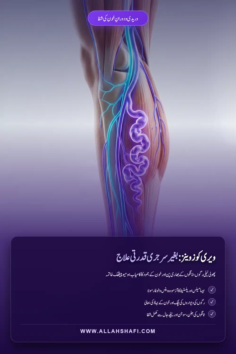 ویری کوز وینز کا ہومیوپیتھک علاج پن