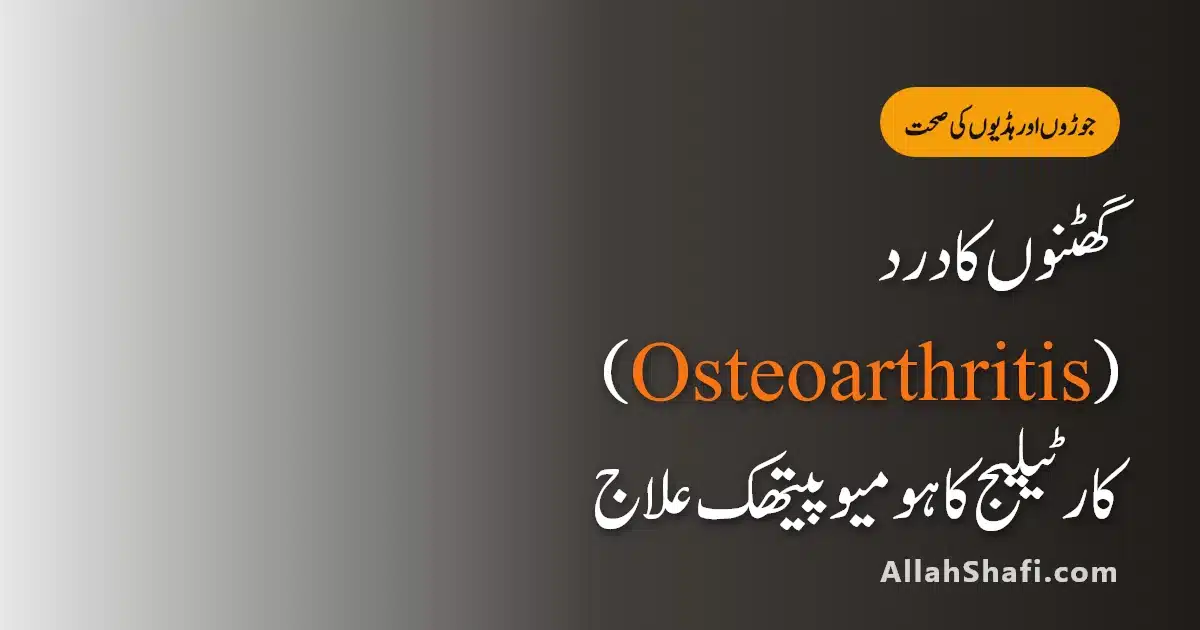 Osteoarthritis Treatment in Urdu